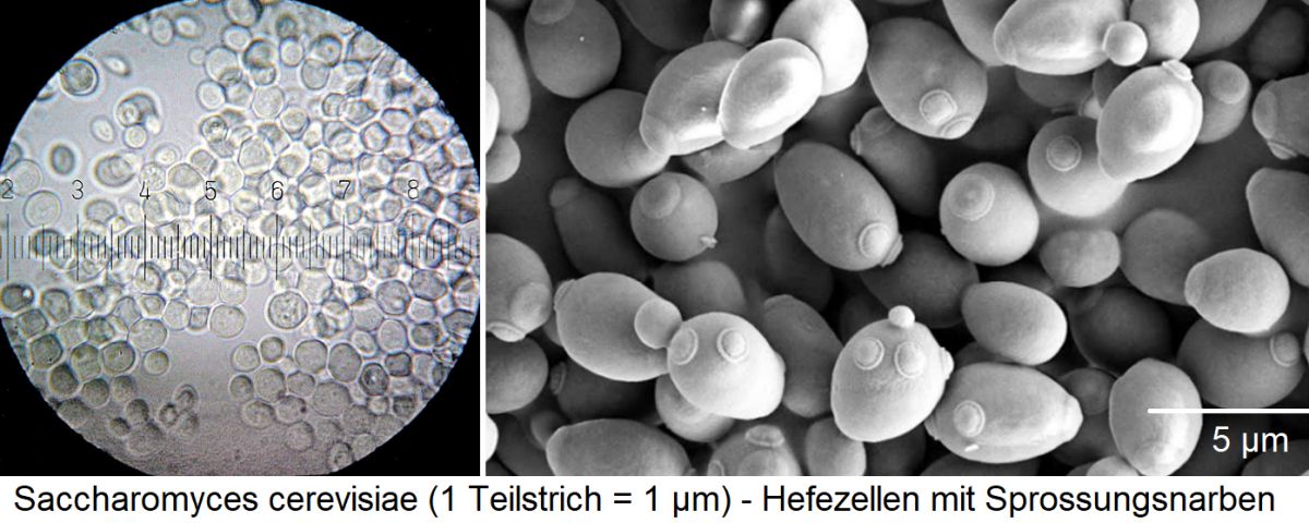 Hefen - Saccharpomyces cerevisiae (1 Teilstrich = 1 µm) - Hefezellen mit Sprossungsnarben